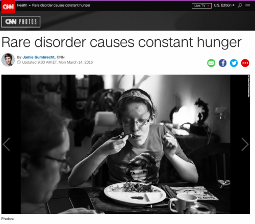 Publications - CNN: Rare disorder causes constant hunger