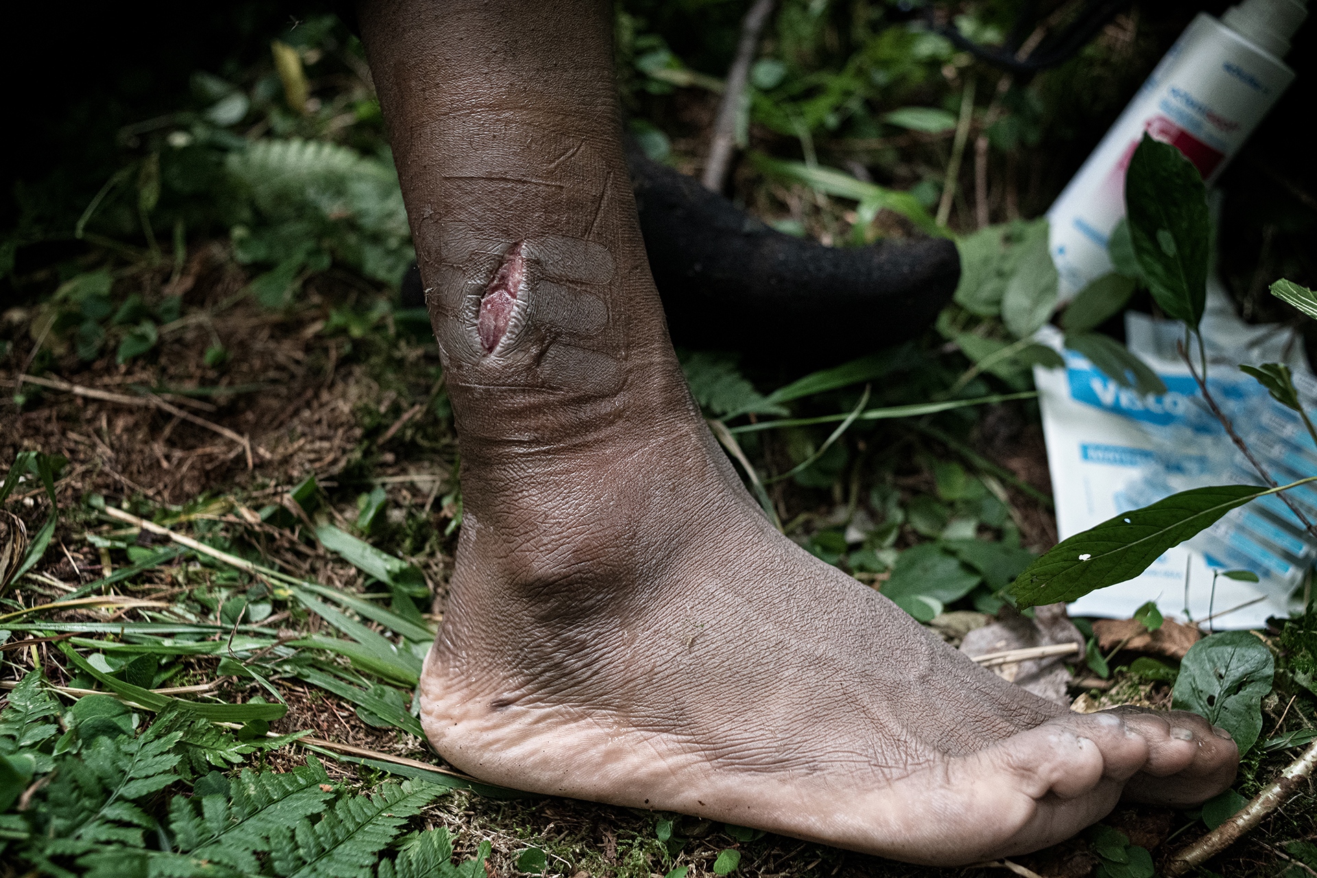   Photo: A refugee from Senegal shows the injuries caused...