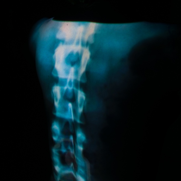 NFT