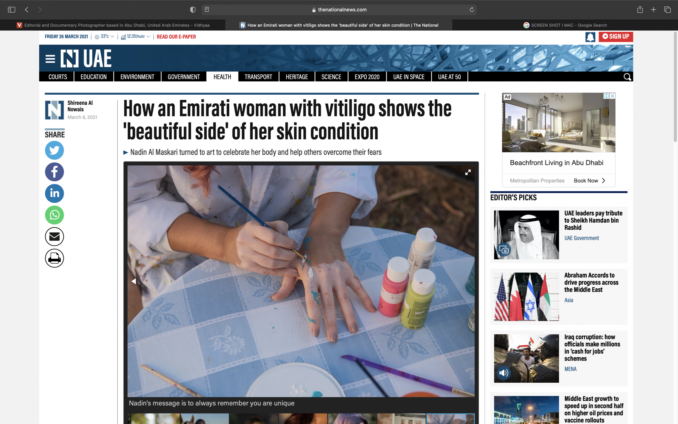 Tearsheets - How an Emirati woman with vitiligo shows the 'beautiful side' of her skin condition